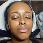 Microdermabrasion Facial