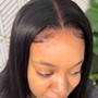 Scalp Treatment