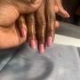 Acrylic Overlay