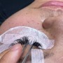 Eyelash Removal