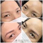 Permanent Makeup removal - Eyebrows