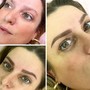 Permanent Makeup removal - Eyebrows