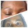 Permanent Makeup Removal