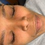 Eyelash Extension Removal