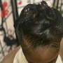 Scalp Treatment