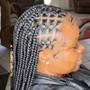 Scalp Treatment