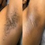 Brazilian and Underarm Wax