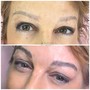 Permanent Makeup removal - Eyebrows