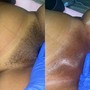 Men Brazilian Wax