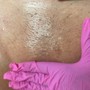 Brazilian Sugaring