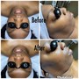 Back Facial