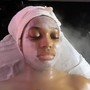 Acne Facial