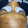 Eyelash Extension Removal