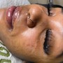 Eyelash Extension Removal