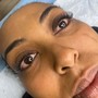 Deep Or acne facial