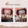 60 min Teeth Whitening - 24K gold