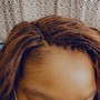 Scalp Treatment