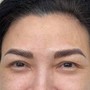 Permanent Makeup removal - Eyebrows