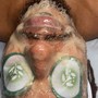 Facial