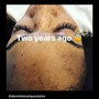 Eyelash Extension Removal