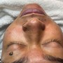 Back Facial