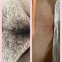 Brazilian Wax ONLY (Must Be 18+)