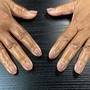 Deep Callus Treatment