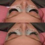 Lash Removal