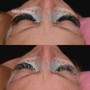 Lash Removal