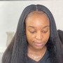 Scalp Treatment