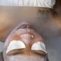 Acne Facial