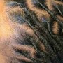 Loc Reattachment