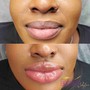 Lip Neutralization (Lip Color Correction for Dark Lips)