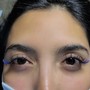 Eyelash Extension Removal