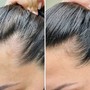 Organic Scalp Treatment