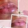 Needless Lips filler 1ml