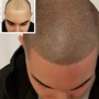 Hair fibers(hairline enhancements)