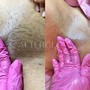 Brazilian Wax