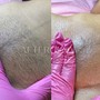 Brazilian Wax