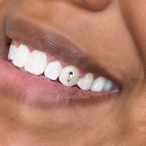 Swarovski Crystal Tooth Gem 