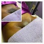 Dermaplaning