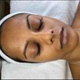 Microdermabrasion