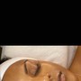 Microdermabrasion