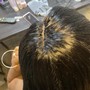 Scalp Treatment