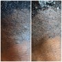 Men’s Brazilian Wax