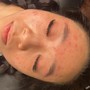 Eyelash Extension Removal