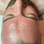 Conditioning Facial