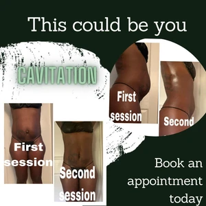 Body Scrub Near Me: Lauderdale Lakes, FL, Appointments