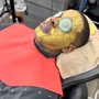 In-grown Hair Extraction