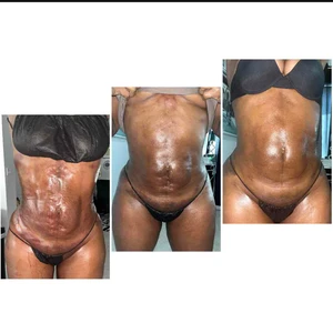 Body Scrub Near Me: Lauderdale Lakes, FL, Appointments